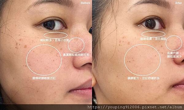 SKINCARE｜膚嘉儞 超Ａ滴滴煥膚精華，目前用過最高濃度1%的A醇精華，緊緻毛孔、撫平細紋和平滑肌膚等多種功