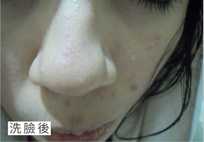 洗臉後.JPG