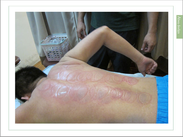 【新竹養生館推薦】解放工程師的僵硬肩膀!不用在跑竹北了!《Fun放輕鬆養生館》滿足夫妻檔按摩的最佳選擇-23.jpg 【新竹養生館推薦】解放工程師的僵硬肩膀!不用在跑竹北了!《Fun放輕鬆養生館》滿足夫妻檔按摩的最佳選擇-23.jpg